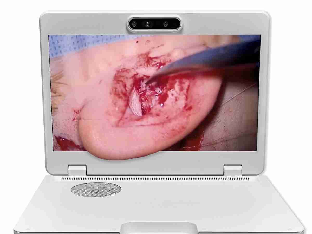 达擎之＂Heads-up 3D显微手术显示系统＂，，整合4K裸眼3D显示及眼球追踪系统，，，，具备快速追踪人眼移动位置功能，，，减轻医师长时间维持固定姿势的负担，，，，让医师能有更宽广清晰的3D立体视野及更舒适的姿势来执行手术。。